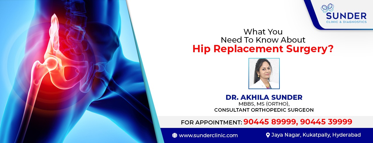 Dr. Akhila Sunder | Hip Replacement Surgeon in Kukatpally